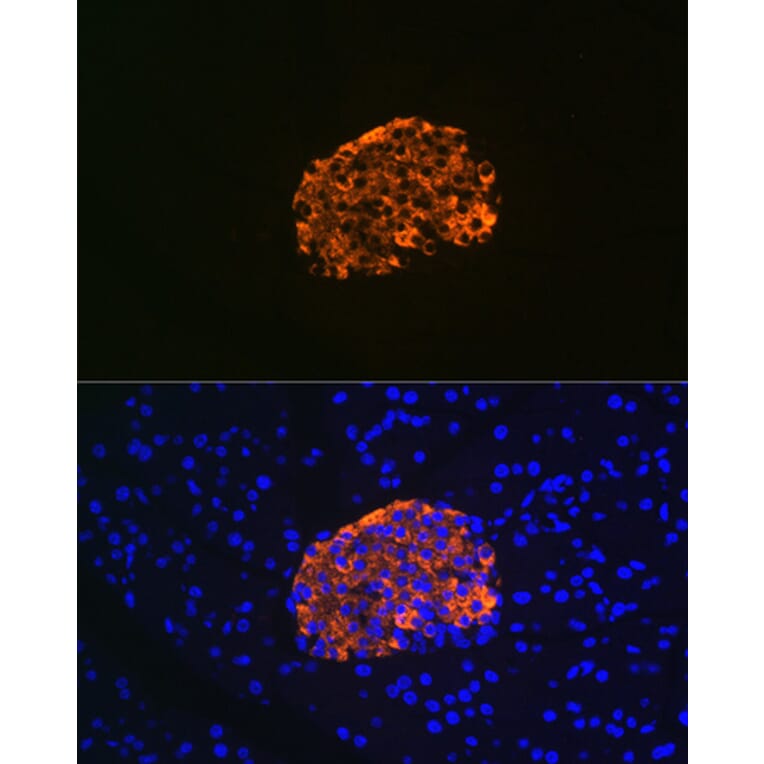 Immunofluorescence - Anti-IGFBP7 Antibody [ARC1052] (A306578) - Antibodies.com