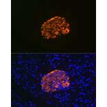 Immunofluorescence - Anti-IGFBP7 Antibody [ARC1052] (A306578) - Antibodies.com