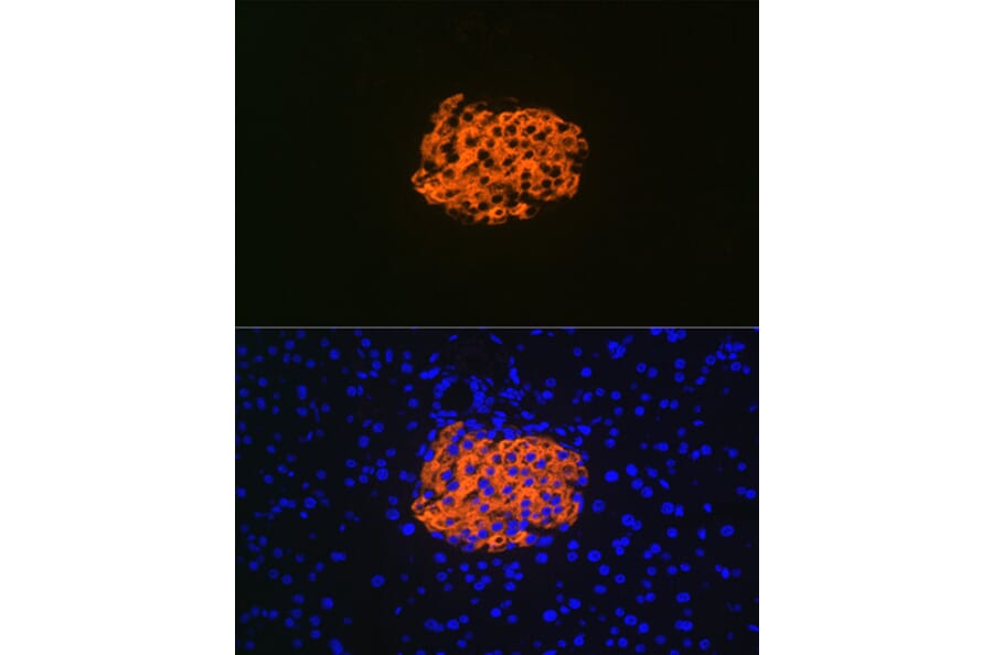 Immunofluorescence - Anti-IGFBP7 Antibody [ARC1052] (A306578) - Antibodies.com