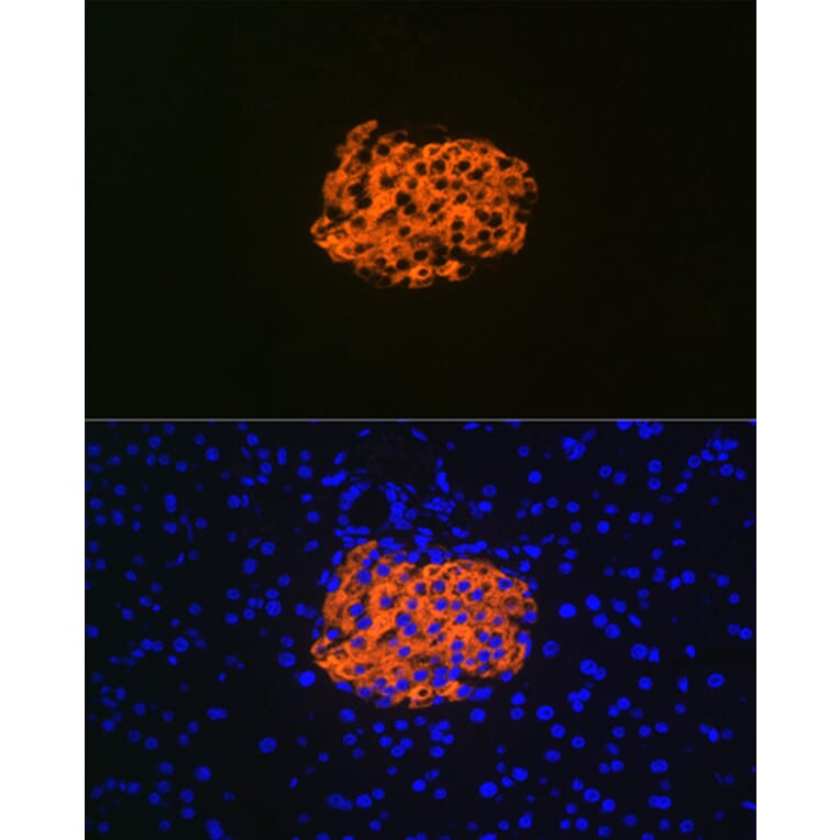 Immunofluorescence - Anti-IGFBP7 Antibody [ARC1052] (A306578) - Antibodies.com