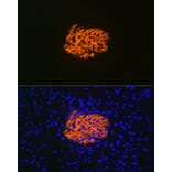 Immunofluorescence - Anti-IGFBP7 Antibody [ARC1052] (A306578) - Antibodies.com
