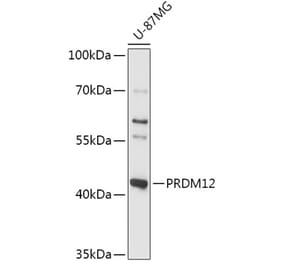 Western Blot - Anti-PRDM12 Antibody (A306580) - Antibodies.com