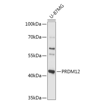 Western Blot - Anti-PRDM12 Antibody (A306580) - Antibodies.com