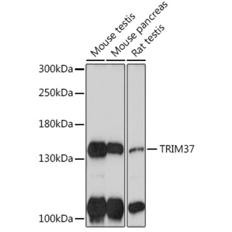 Western Blot - Anti-TRIM37/MUL Antibody (A306583) - Antibodies.com