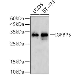 Western Blot - Anti-IGFBP5 Antibody (A306585) - Antibodies.com