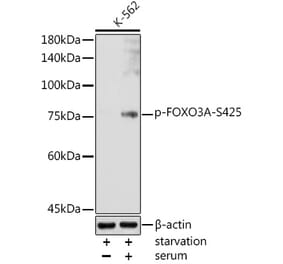 Western Blot - Anti-FOXO3A (phospho Ser425) Antibody (A306586) - Antibodies.com