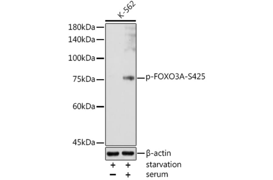 Western Blot - Anti-FOXO3A (phospho Ser425) Antibody (A306586) - Antibodies.com