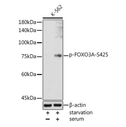Western Blot - Anti-FOXO3A (phospho Ser425) Antibody (A306586) - Antibodies.com