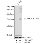 Western Blot - Anti-FOXO3A (phospho Ser425) Antibody (A306586) - Antibodies.com