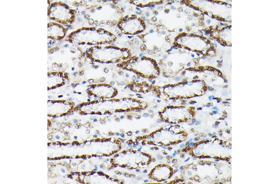 Immunohistochemistry - Anti-FOXO3A (phospho Ser425) Antibody (A306586) - Antibodies.com