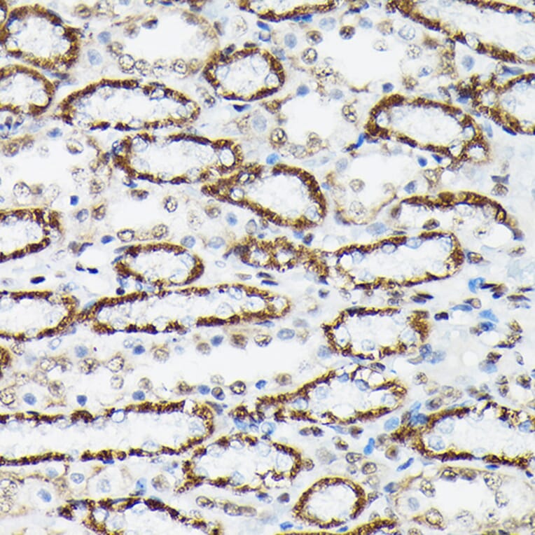 Immunohistochemistry - Anti-FOXO3A (phospho Ser425) Antibody (A306586) - Antibodies.com