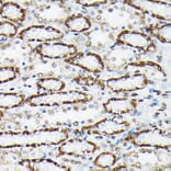 Immunohistochemistry - Anti-FOXO3A (phospho Ser425) Antibody (A306586) - Antibodies.com