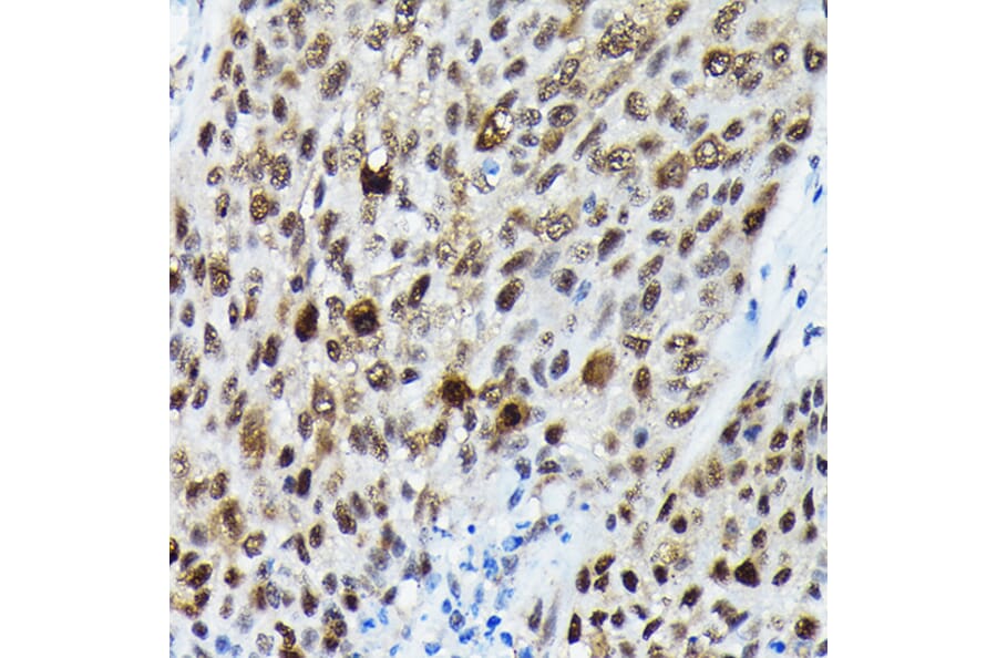 Immunohistochemistry - Anti-FOXO3A (phospho Ser425) Antibody (A306586) - Antibodies.com