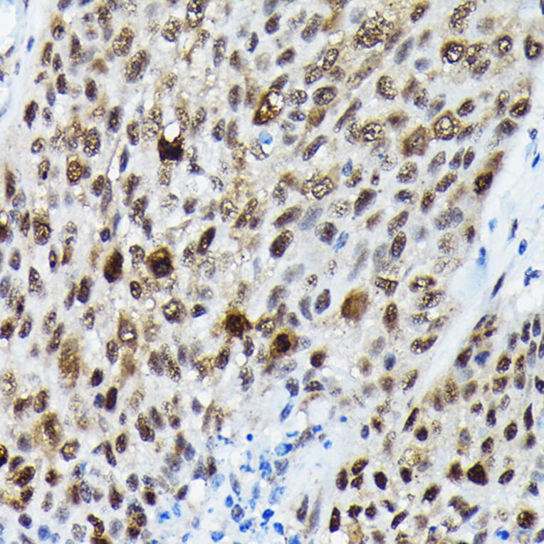 Immunohistochemistry - Anti-FOXO3A (phospho Ser425) Antibody (A306586) - Antibodies.com