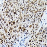 Immunohistochemistry - Anti-FOXO3A (phospho Ser425) Antibody (A306586) - Antibodies.com