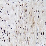 Immunohistochemistry - Anti-FOXO3A (phospho Ser425) Antibody (A306586) - Antibodies.com