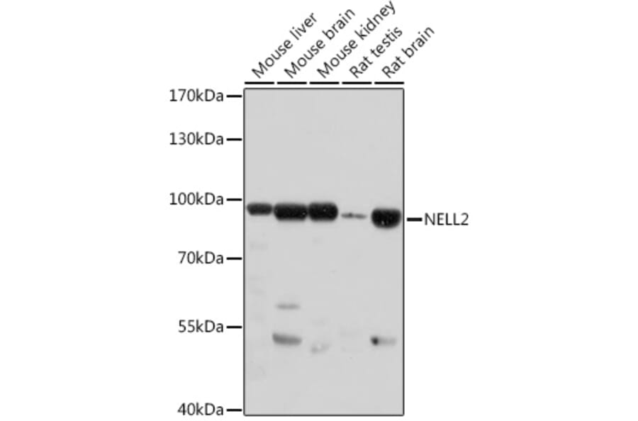 Western Blot - Anti-NELL2 Antibody (A306588) - Antibodies.com