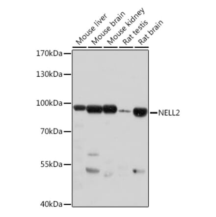 Western Blot - Anti-NELL2 Antibody (A306588) - Antibodies.com