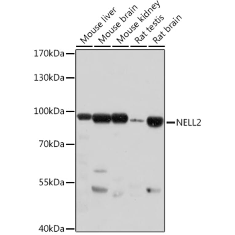 Western Blot - Anti-NELL2 Antibody (A306588) - Antibodies.com