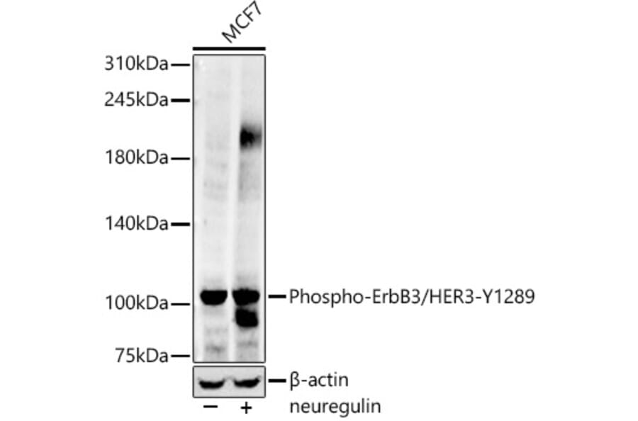 Western Blot - Anti-ErbB3/HER3 (phospho Tyr1289) Antibody [ARC58831] (A306589) - Antibodies.com