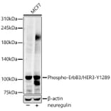 Western Blot - Anti-ErbB3/HER3 (phospho Tyr1289) Antibody [ARC58831] (A306589) - Antibodies.com