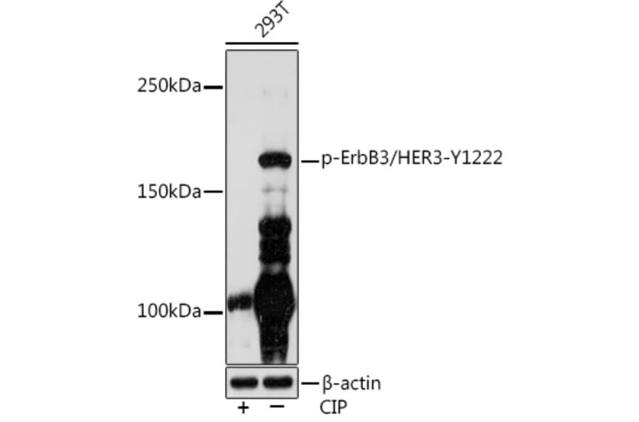 Western Blot - Anti-ErbB3/HER3 (phospho Tyr1222) Antibody (A306590) - Antibodies.com