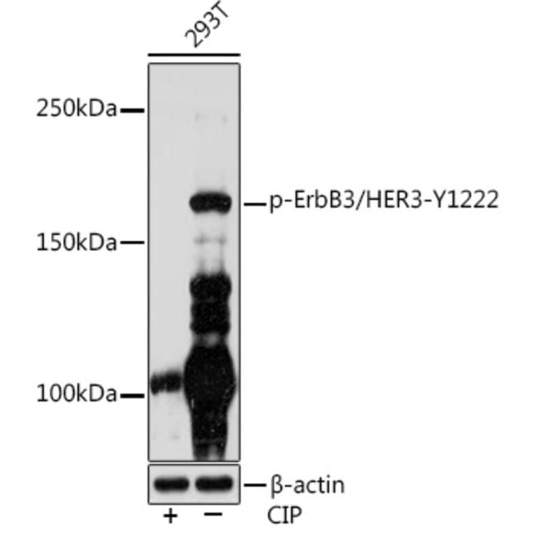 Western Blot - Anti-ErbB3/HER3 (phospho Tyr1222) Antibody (A306590) - Antibodies.com