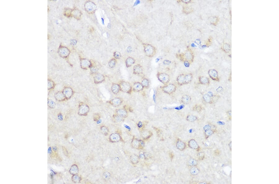 Immunohistochemistry - Anti-Adenosine A1 Receptor Antibody (A306591) - Antibodies.com