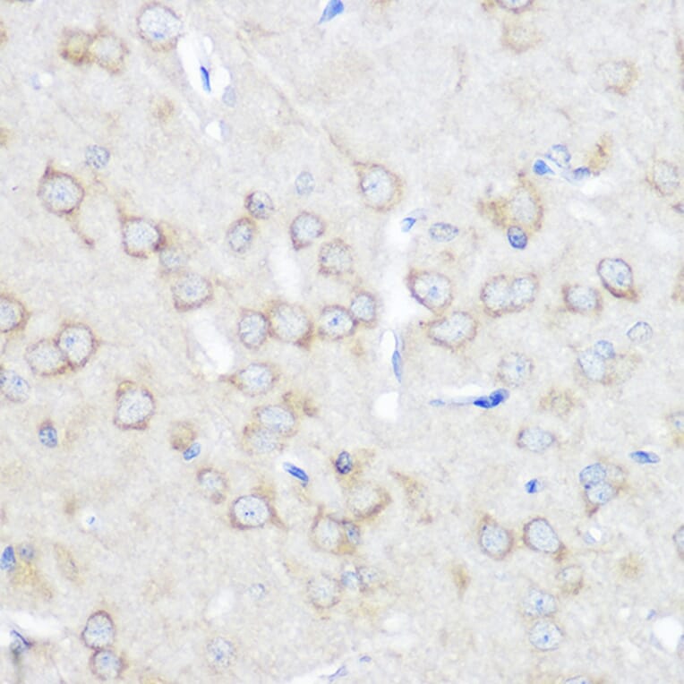 Immunohistochemistry - Anti-Adenosine A1 Receptor Antibody (A306591) - Antibodies.com