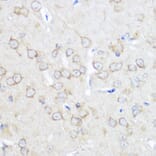 Immunohistochemistry - Anti-Adenosine A1 Receptor Antibody (A306591) - Antibodies.com