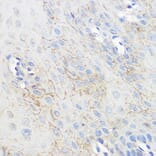 Immunohistochemistry - Anti-Adenosine A1 Receptor Antibody (A306591) - Antibodies.com
