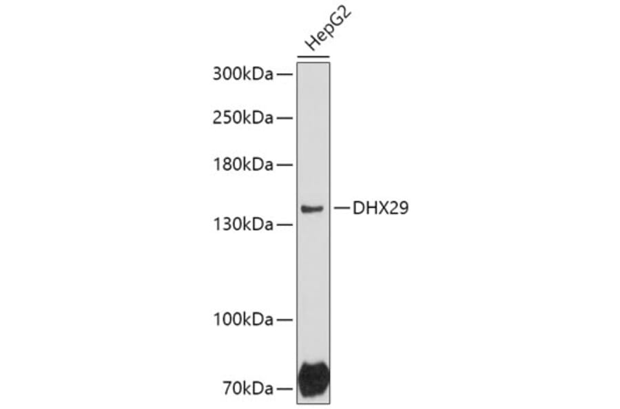 Western Blot - Anti-DHX29 Antibody (A306592) - Antibodies.com
