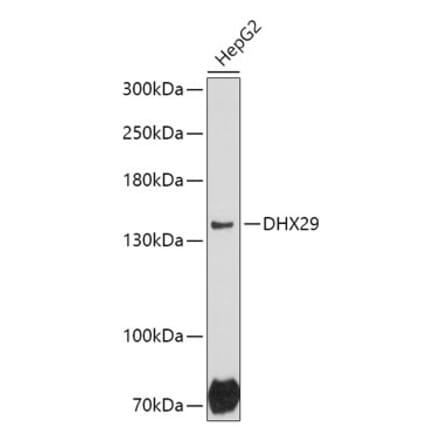 Western Blot - Anti-DHX29 Antibody (A306592) - Antibodies.com