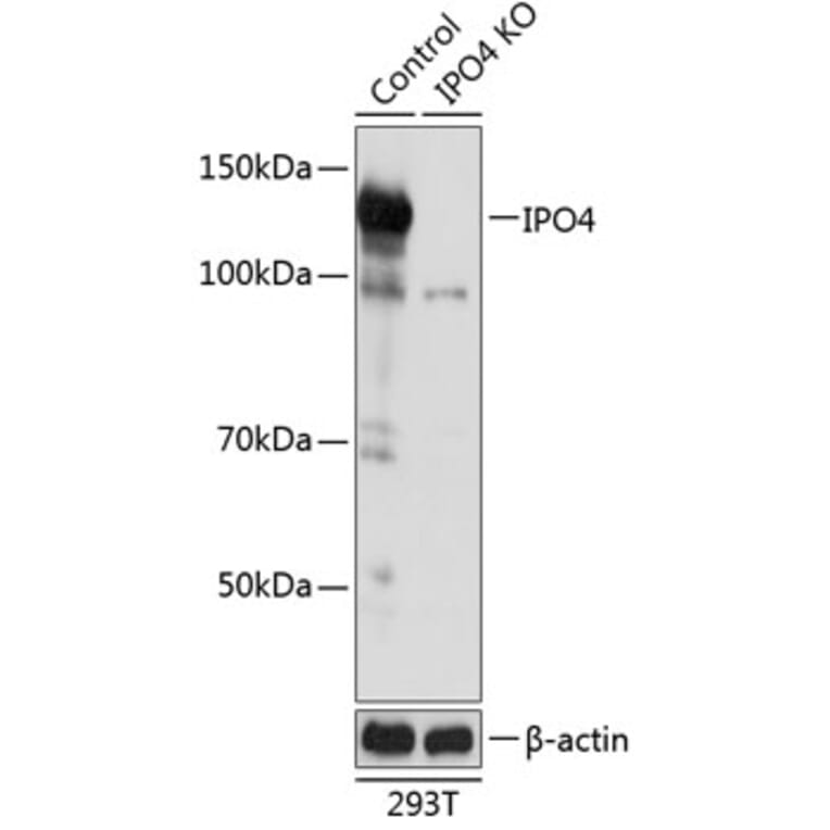 Western Blot - Anti-Importin4/Imp4 Antibody (A306593) - Antibodies.com
