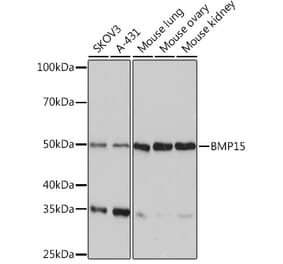 Western Blot - Anti-BMP15 Antibody [ARC0907] (A306596) - Antibodies.com