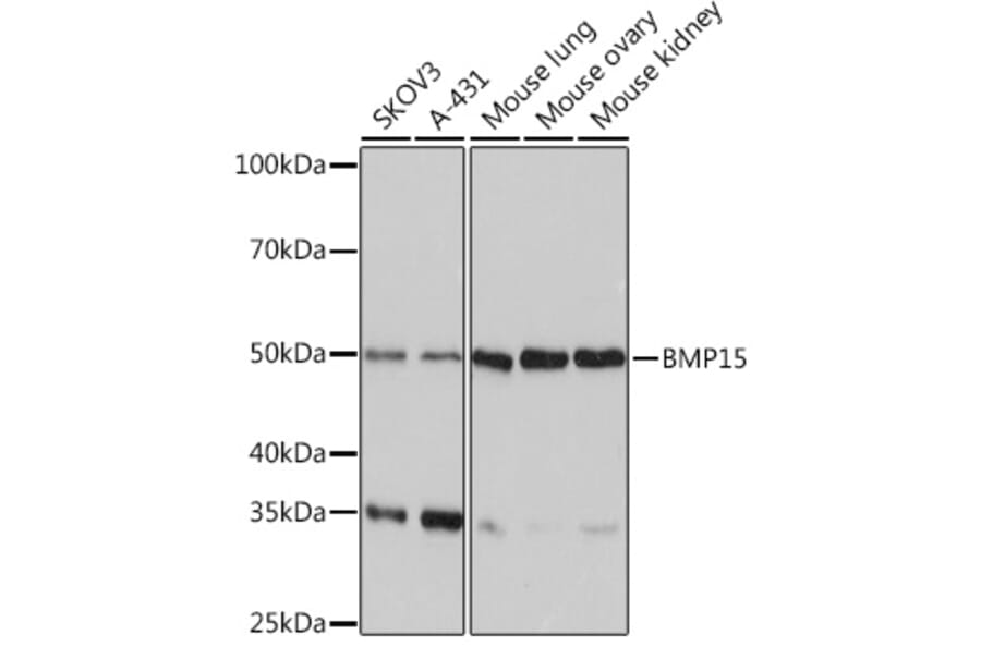 Western Blot - Anti-BMP15 Antibody [ARC0907] (A306596) - Antibodies.com