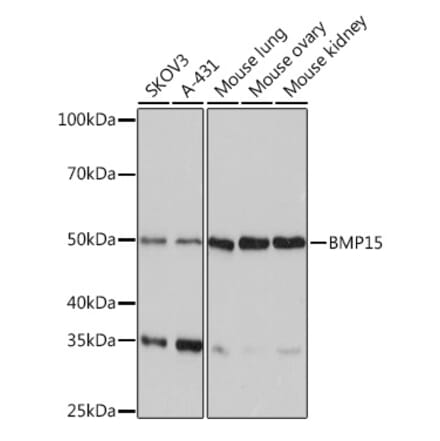 Western Blot - Anti-BMP15 Antibody [ARC0907] (A306596) - Antibodies.com