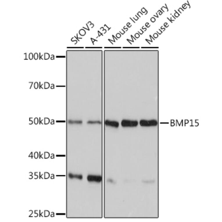 Western Blot - Anti-BMP15 Antibody [ARC0907] (A306596) - Antibodies.com