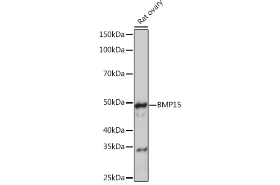 Western Blot - Anti-BMP15 Antibody [ARC0907] (A306596) - Antibodies.com
