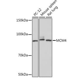Western Blot - Anti-MCM4 Antibody [ARC1491] (A306597) - Antibodies.com
