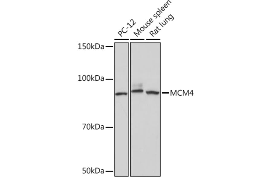 Western Blot - Anti-MCM4 Antibody [ARC1491] (A306597) - Antibodies.com