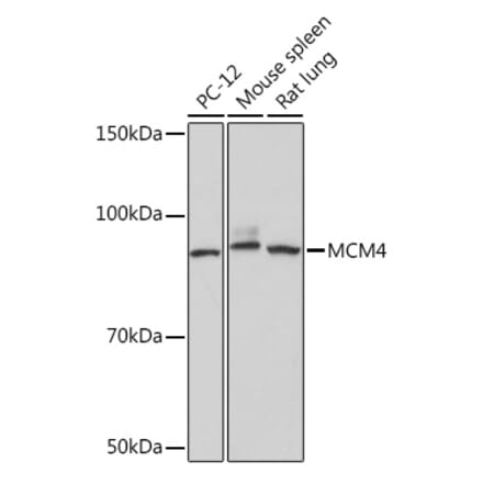 Western Blot - Anti-MCM4 Antibody [ARC1491] (A306597) - Antibodies.com