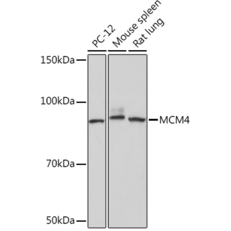 Western Blot - Anti-MCM4 Antibody [ARC1491] (A306597) - Antibodies.com