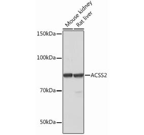 Western Blot - Anti-ACSS2 Antibody [ARC0690] (A306598) - Antibodies.com