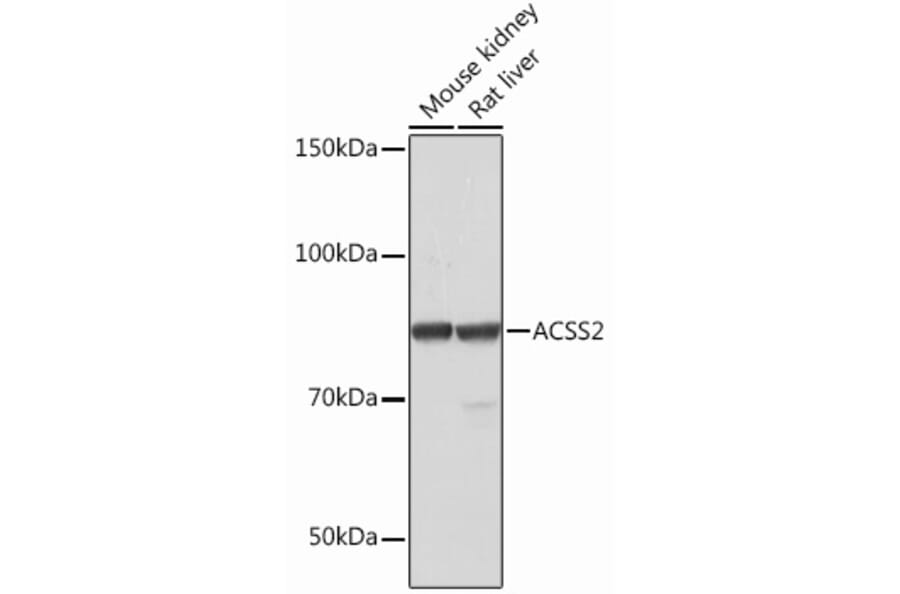 Western Blot - Anti-ACSS2 Antibody [ARC0690] (A306598) - Antibodies.com