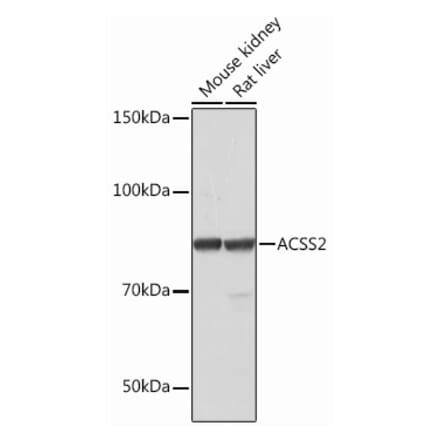 Western Blot - Anti-ACSS2 Antibody [ARC0690] (A306598) - Antibodies.com