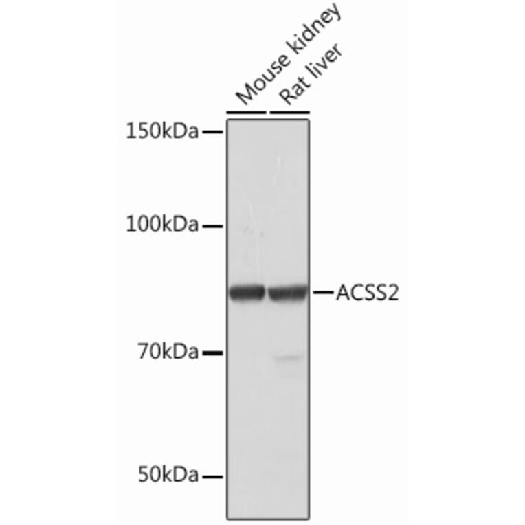 Western Blot - Anti-ACSS2 Antibody [ARC0690] (A306598) - Antibodies.com