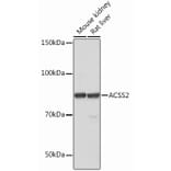 Western Blot - Anti-ACSS2 Antibody [ARC0690] (A306598) - Antibodies.com