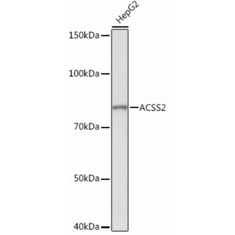 Western Blot - Anti-ACSS2 Antibody [ARC0690] (A306598) - Antibodies.com