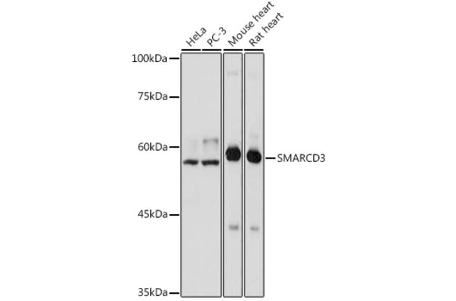 Western Blot - Anti-BAF60C Antibody (A306600) - Antibodies.com